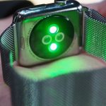 Apple Watch Bisa Mendeteksi Kelainan Jantung